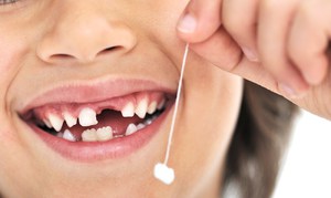 Lorsque les dents de lait commencent à tomber, il faut prêter une attention particulière à l'hygiène buccale.