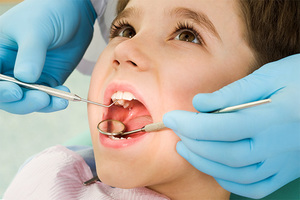 Les caries des enfants