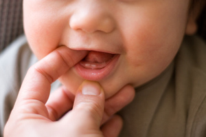 Quelles manières d'aider l'enfant avec la dentition