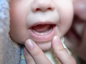 Séquence de dentition chez le nourrisson
