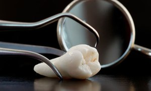 Un anesthésiste lors de l'extraction d'une dent doit surveiller la réponse du patient à l'anesthésie.