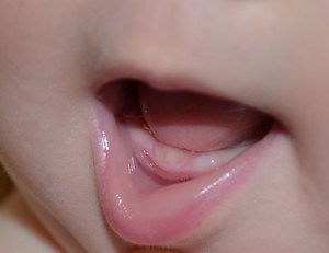 Comment apprendre à un enfant à se brosser les dents