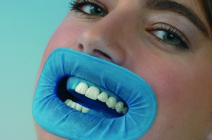 Les dents sont maintenant isolées de la salive à l'aide d'un matériau spécial.