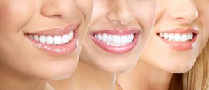 De beaux sourires peuvent être différents
