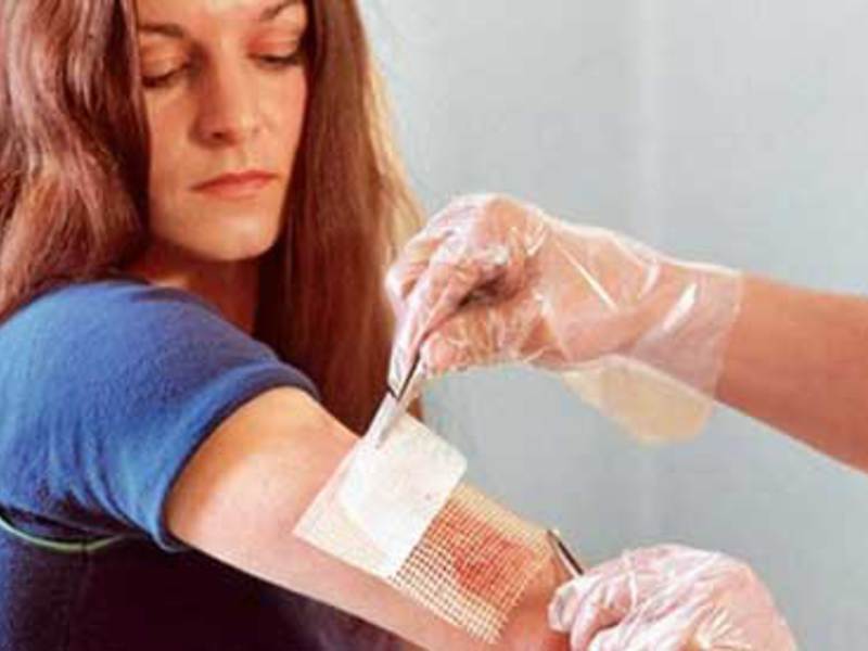 Utilisation de chlorhexidine pour désinfecter les plaies et les brûlures Quelle est la composition du médicament Chlorhexidine