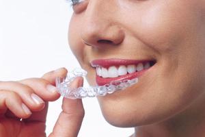 Types de plaques sur les dents