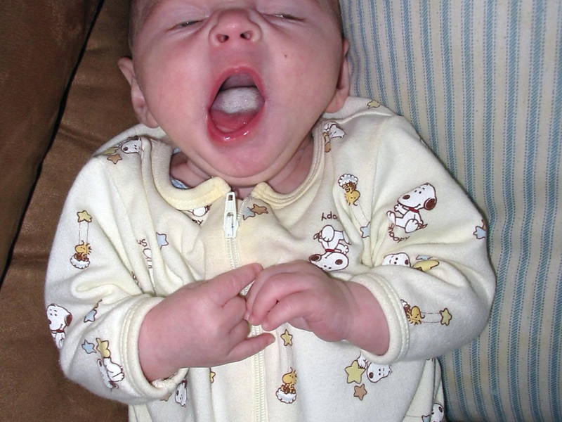 Plaque blanche dans la bouche d'un bébé Comment aider votre enfant pendant la stomatite