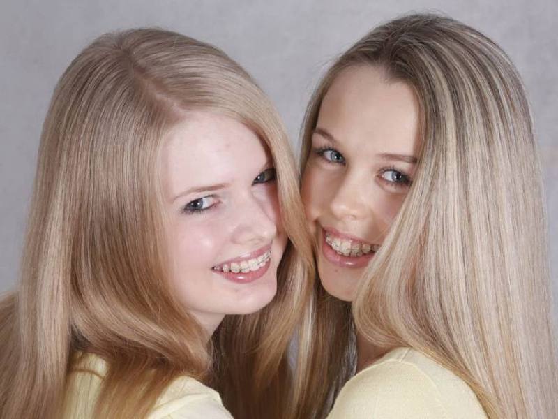 Causes de malocclusion